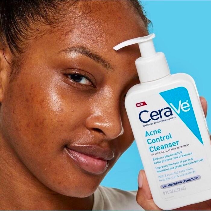 CeraVe Acne Control Cleanser 237ml – sparklingbeautybd.com